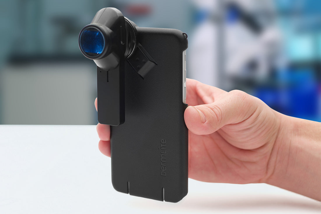 DermLite DL1 | Dermatoscopes.com