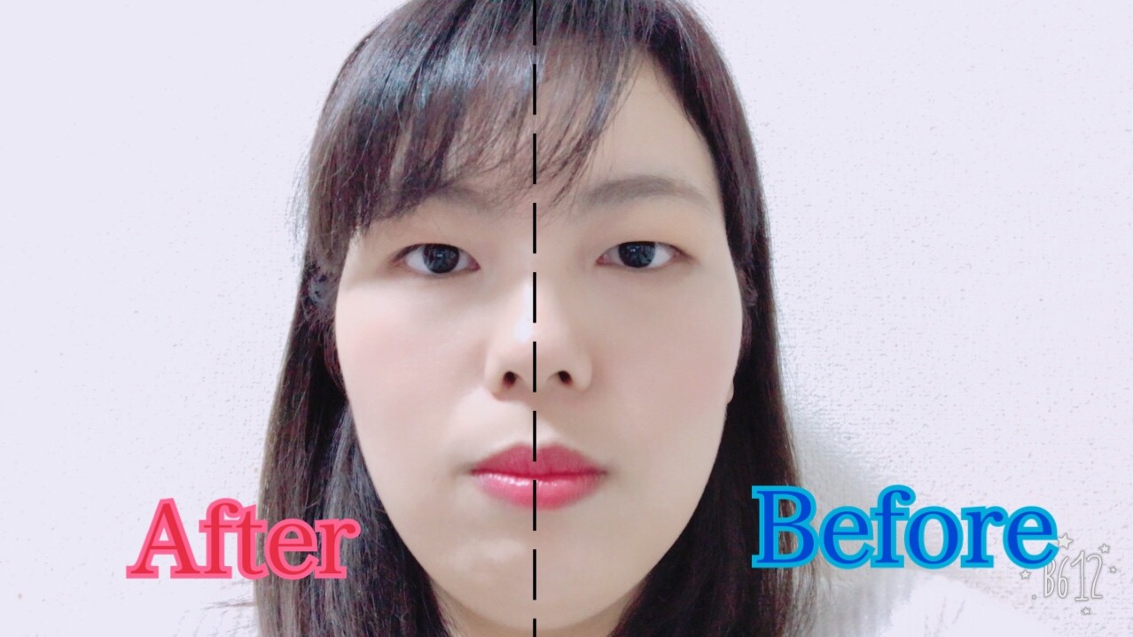 かんたんリフトアップ！！マグネティックフロー！！｜コラム 美容室