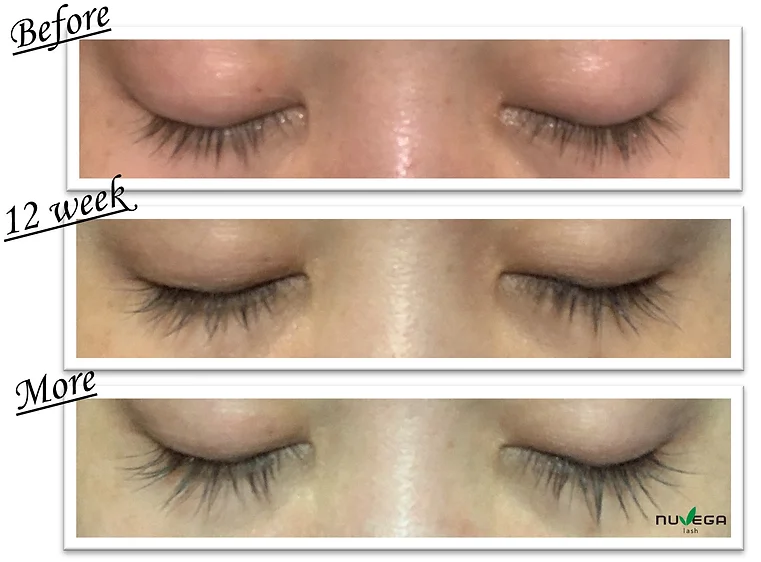 evoeye アイラッシュフォーミュラ | Merelle Online Store