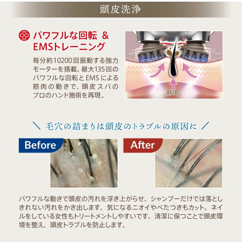 楽天市場】【正規品】 ゾーガンキンスカルプ EMS ヘッドスパ ZOGANKIN