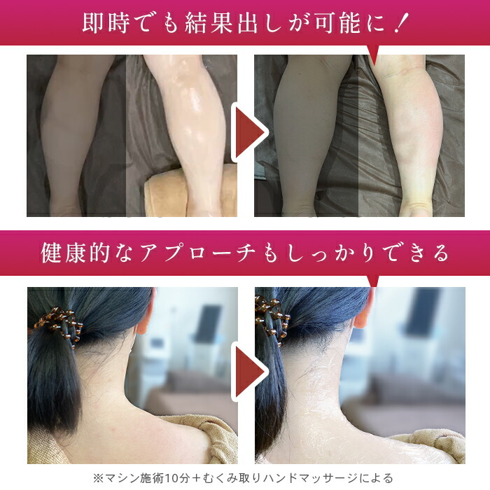 楽天市場】ラジオ波 吸引 エステ機器 RADI CRASH 同時出力【日本製