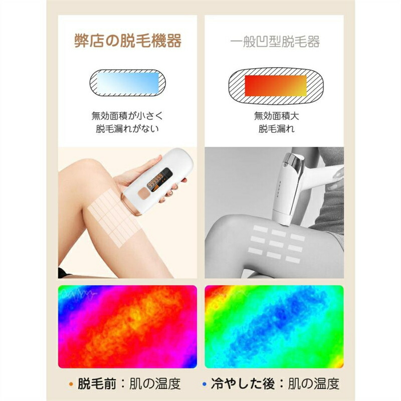 楽天市場】SNS人気 話題の 脱毛器 家庭用 全身使用可 5段階照射 男女