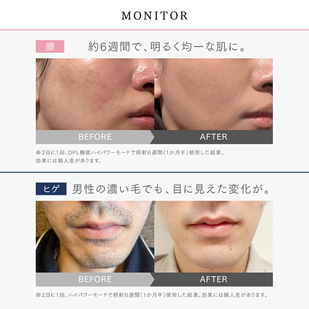 楽天市場】値上げ前最後のSSセール！SS限定 40%OFFクーポン