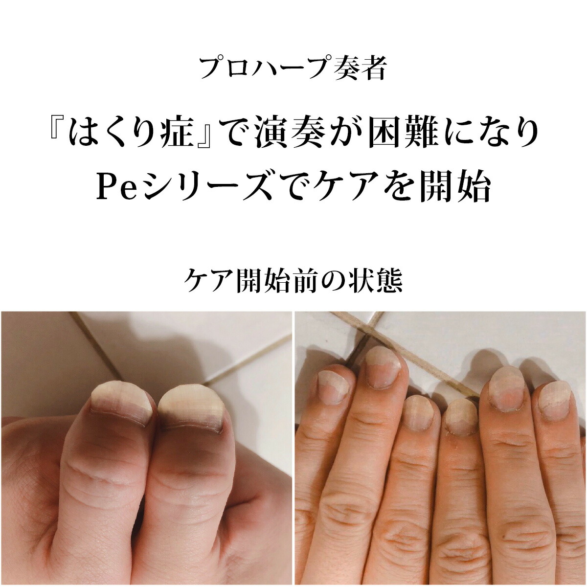 楽天市場】【楽天SS 20%OFF】プロトン水 Pe-ローション 150ml 3本