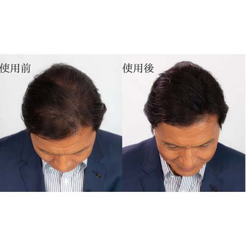 楽天市場】スーパーミリオンヘアー No.23 ミディアムブラウン(30g*3個