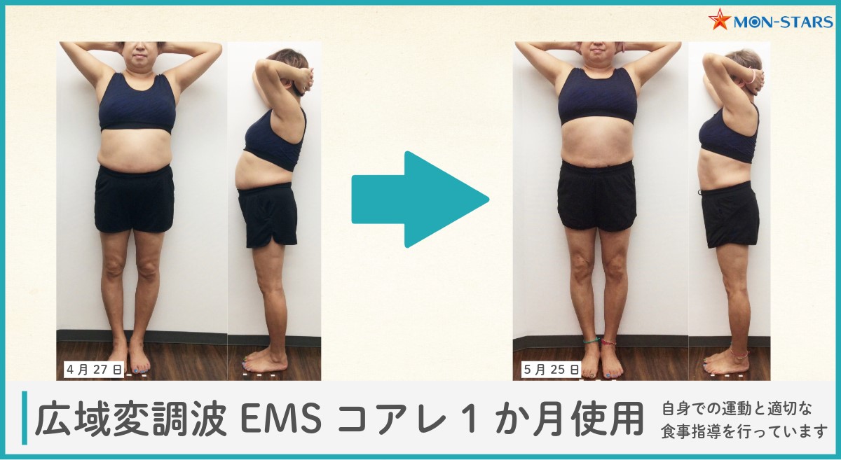 EMSトレーニングの効果とは？自重トレーニングとの違いや注意点を解説