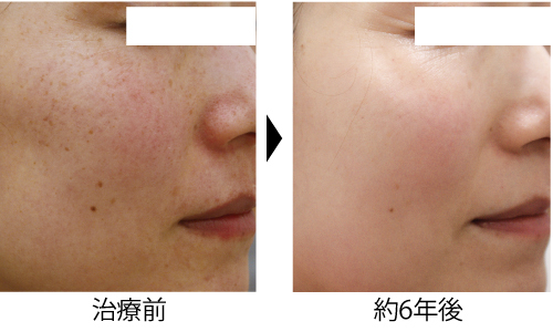 DFモバイルに驚き！！DF押しです！！ | 徳島の美容クリニック 赤池