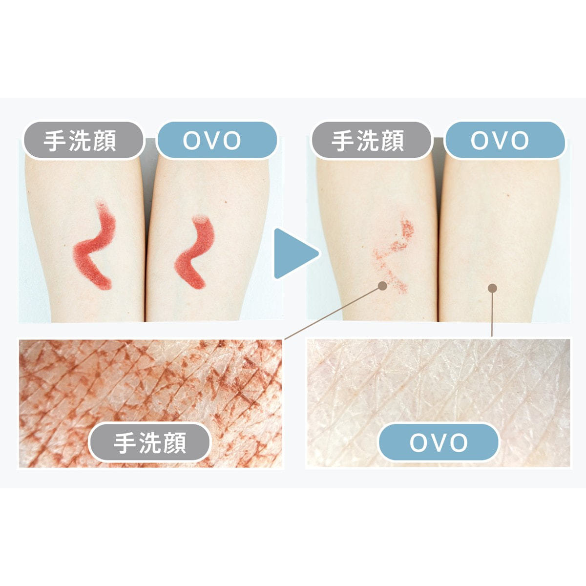 ZOGANKIN OVO（ゾーガンキン オーヴォ）の卸・通販 | ビューティガレージ