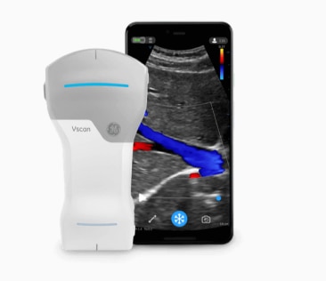 Vscan Air Details | GE HealthCare (Japan)