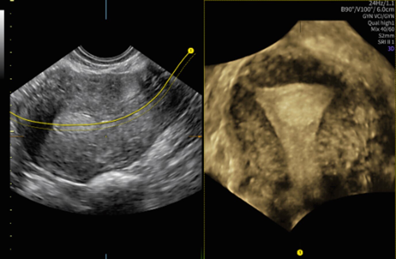 GEヘルスケア・ジャパン 産婦人科向け超音波画像診断装置「Voluson