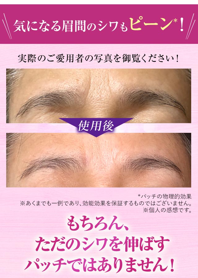 北の快適工房｜『ミケンディープパッチ』