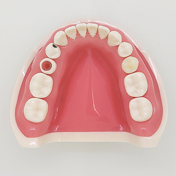 統合型実習用模型 [D16HD-X.1602]｜株式会社ニッシン｜歯科模型・歯科