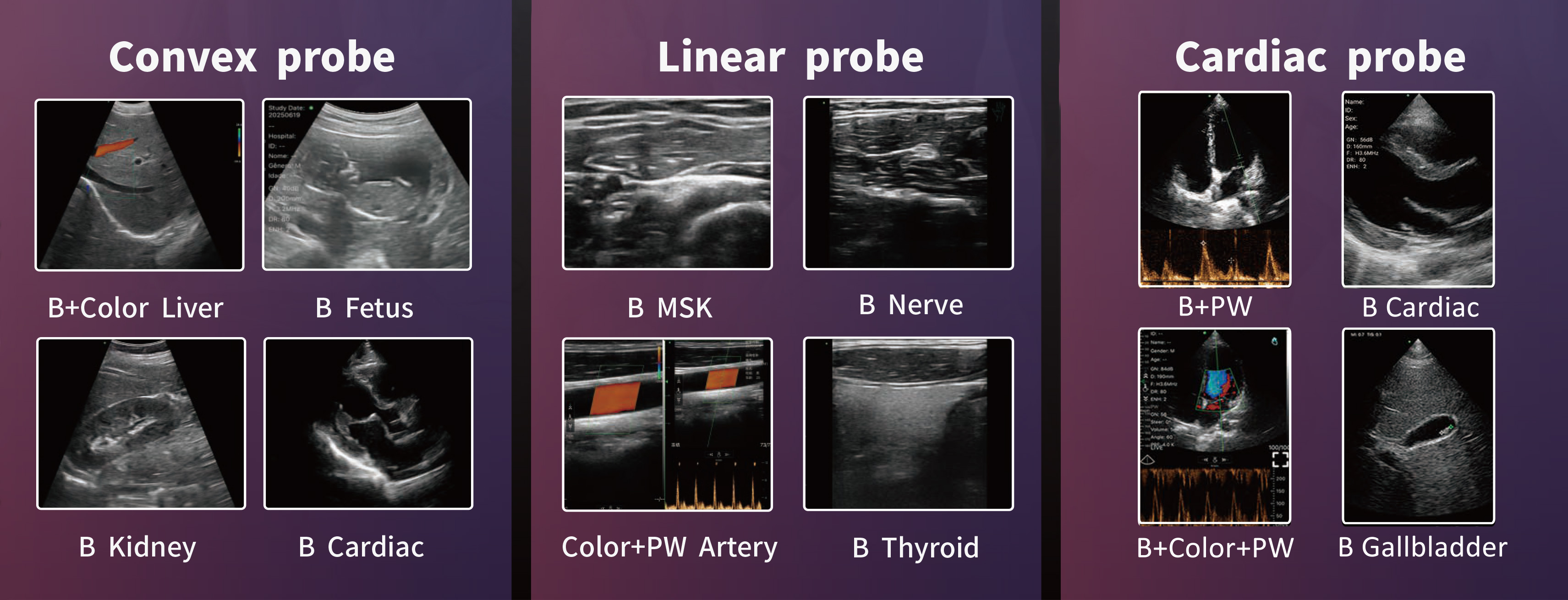 USB&Wi-Fi接続可能 超音波画像測定「FAMUBO-Z」｜体組成の研究・開発の