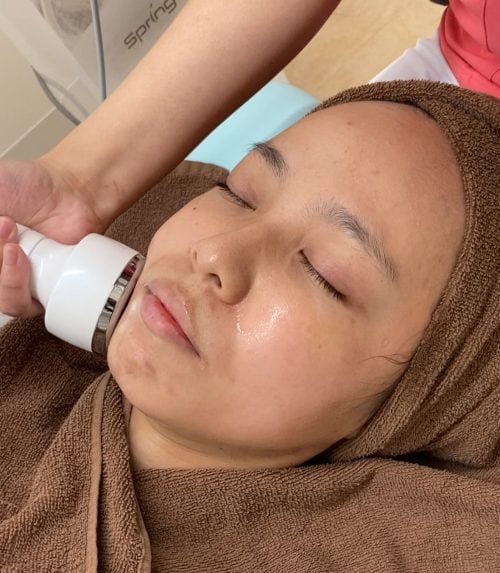 肌育】エレクトロポレーション(イオン導入)の効果とは？レーザー併用が