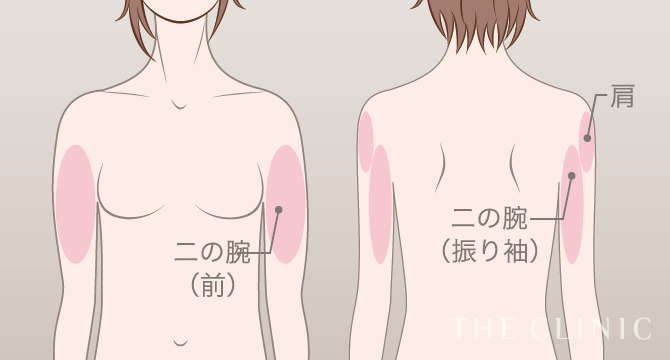 二の腕・肩の脂肪吸引｜脂肪吸引専門のTHE CLINIC
