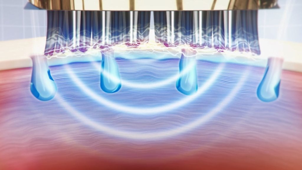 ヴェーダスカルプブラシBS for Salon』新発売 | ヤーマン株式会社