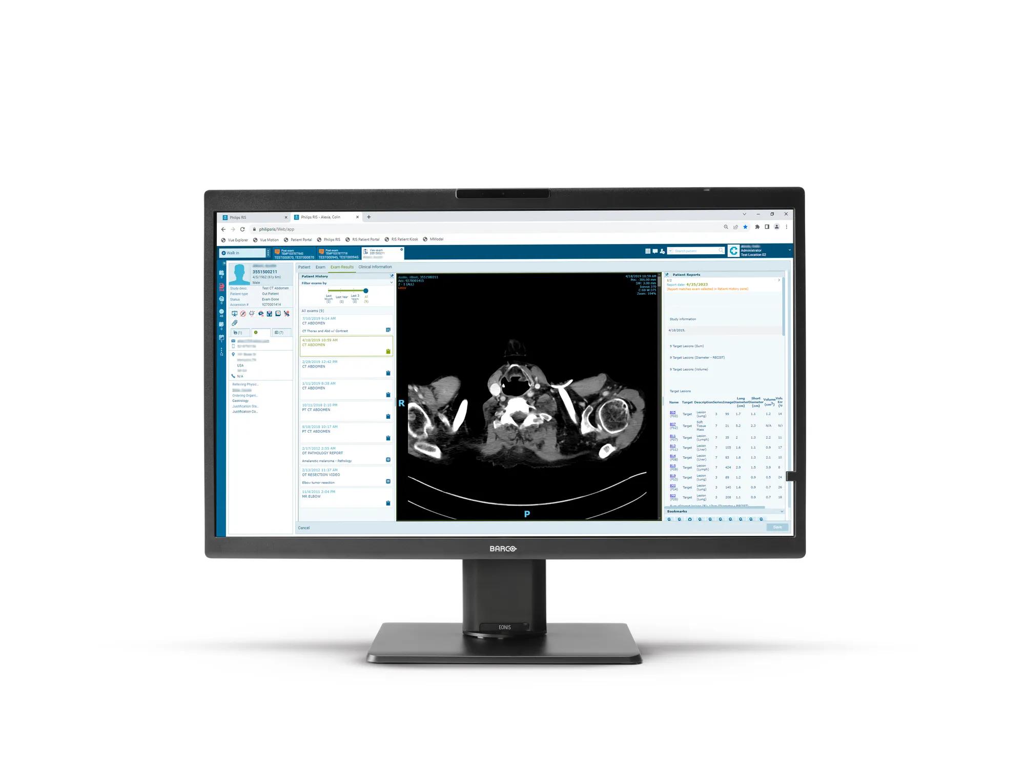 Eonisカラー8MP (MDRC-8132) - クリニカルレビュー・ディスプレイ