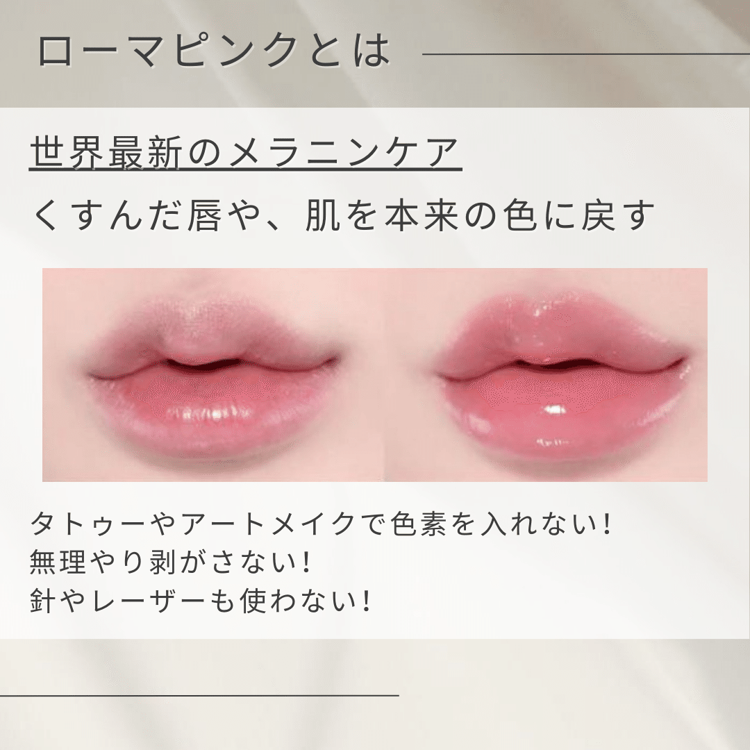 ローマピンクという新技術！！｜shu-salon