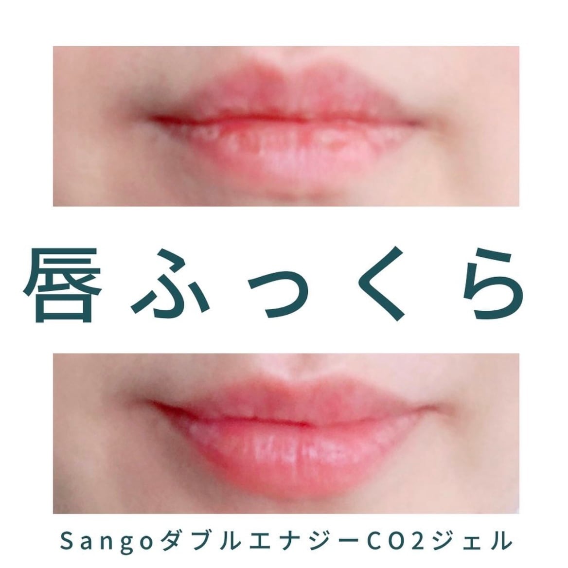 Sango】ダブルエナジーCO2ジェル5回分(高濃度炭酸パック) | nemuriselect