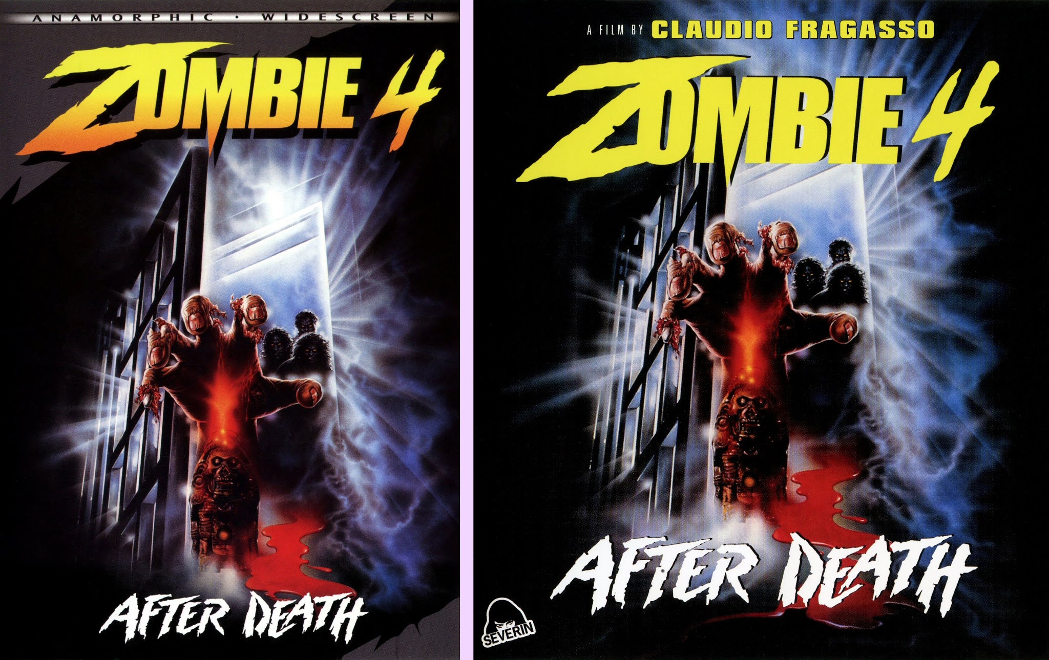 DVD Exotica: Zombie 4, Just Because