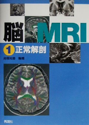 脳MRI(1) 正常解剖 中古本・書籍 | ブックオフ公式オンラインストア