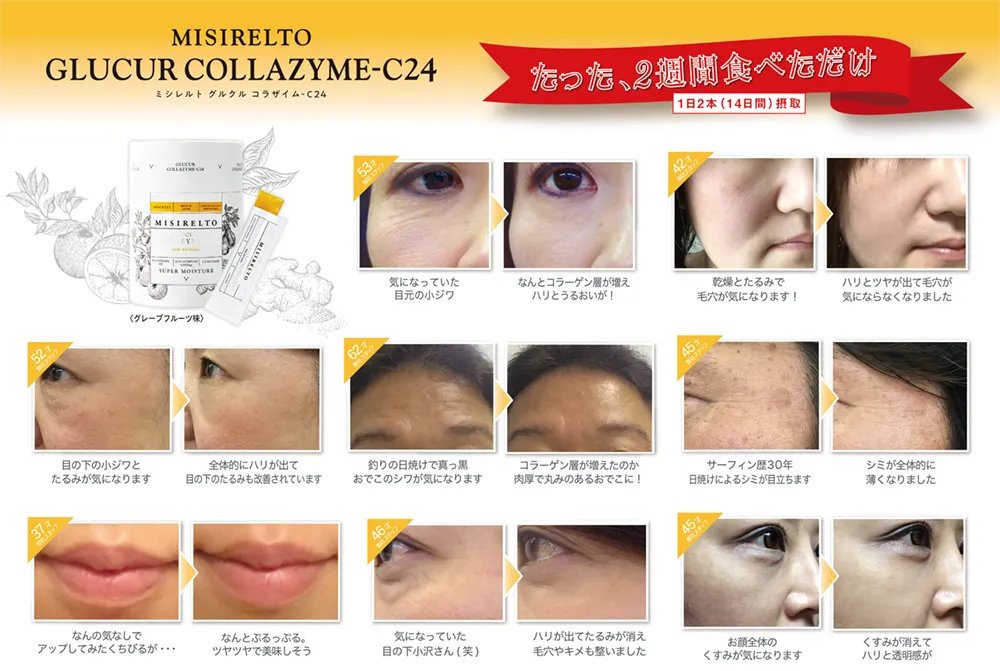 ミシレルト】グルクルコラザイムC24 | 業務用美容・エステ機器の卸・仕