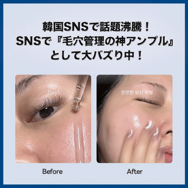 Qoo10] Dermela 【ファヘ1位】PDRN 針美容液 50m