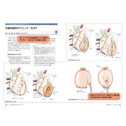 心臓血管外科手術エクセレンス③ 冠動脈疾患の手術 心臓血管外科手術エクセレンス 3 冠動脈疾患の手術 | 神陵文庫