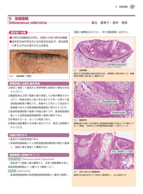 1冊でわかる皮膚病理 第2版 (皮膚科サブスペシャリティーシリーズ