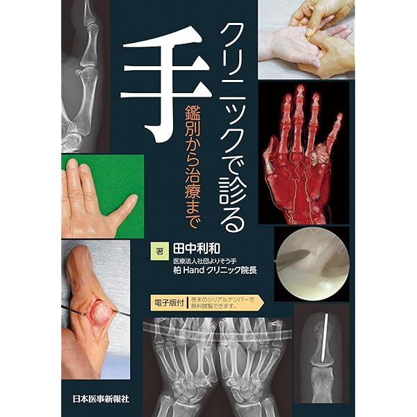 手の外科―私のアプローチ 第2版 | 三浪 明男 |本 | 通販 | Amazon
