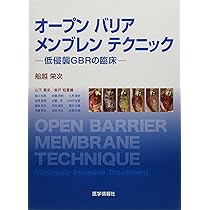 Amazon.co.jp: オープンバリアメンブレンテクニック: 低侵襲GBRの臨床