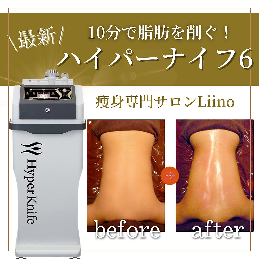 リーノ プロデュースド バイ ティービーピー(Liino Produced by TBP