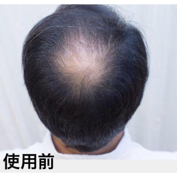 増毛ふりかけ ヘアーファンデーション詰替え 分け目白髪隠しカバー