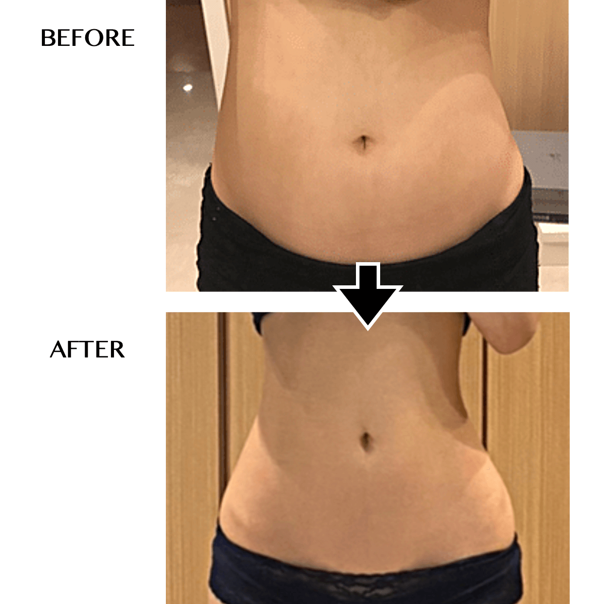 CELLZERO BAG | 「じぶんdeエステ」オンラインショップ【公式】