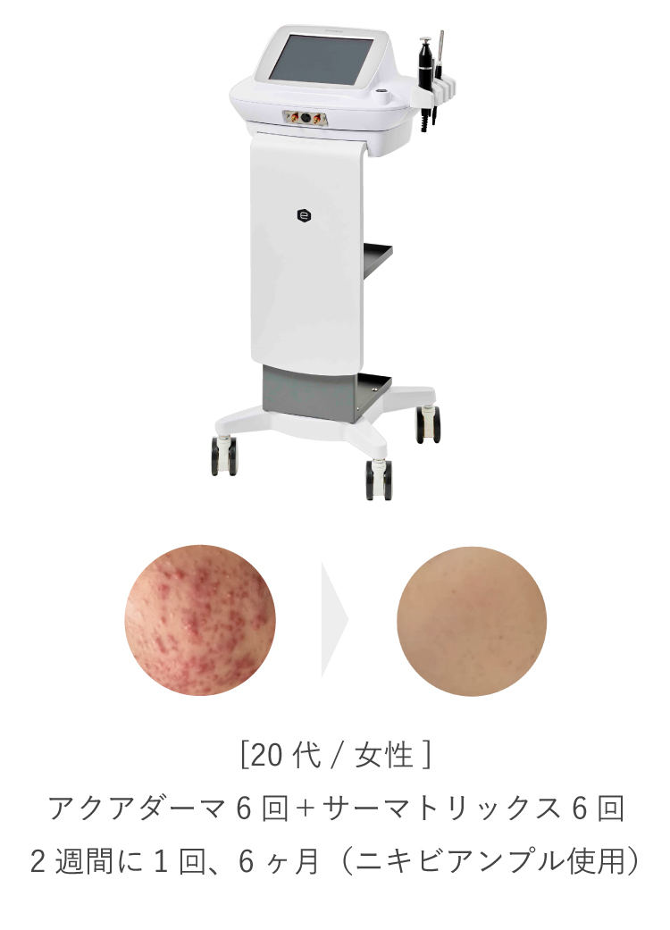 サーマトリックス - ラニィエンボーテ - LaNhien Beauté