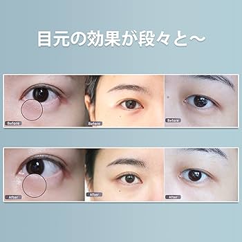 Amazon.co.jp: TAQISONG 目元美顔器 目元ケア 目元エステ ems美顔器