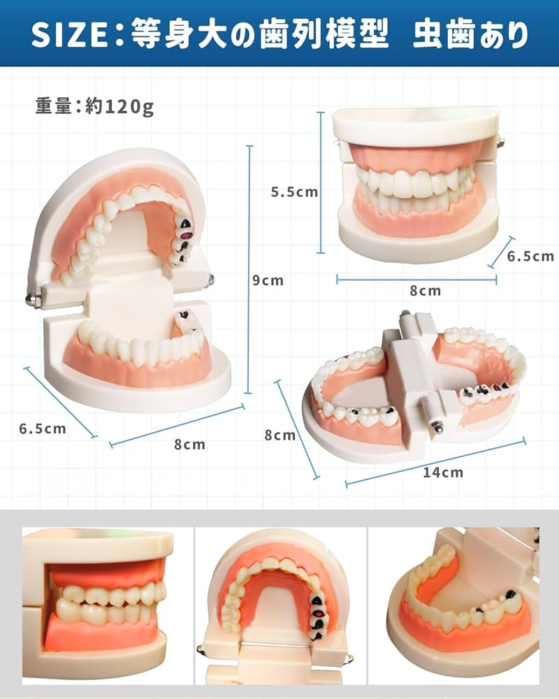 Amazon.co.jp: KIYOMARU パカっと開口できる虫歯付き歯列模型 人体模型