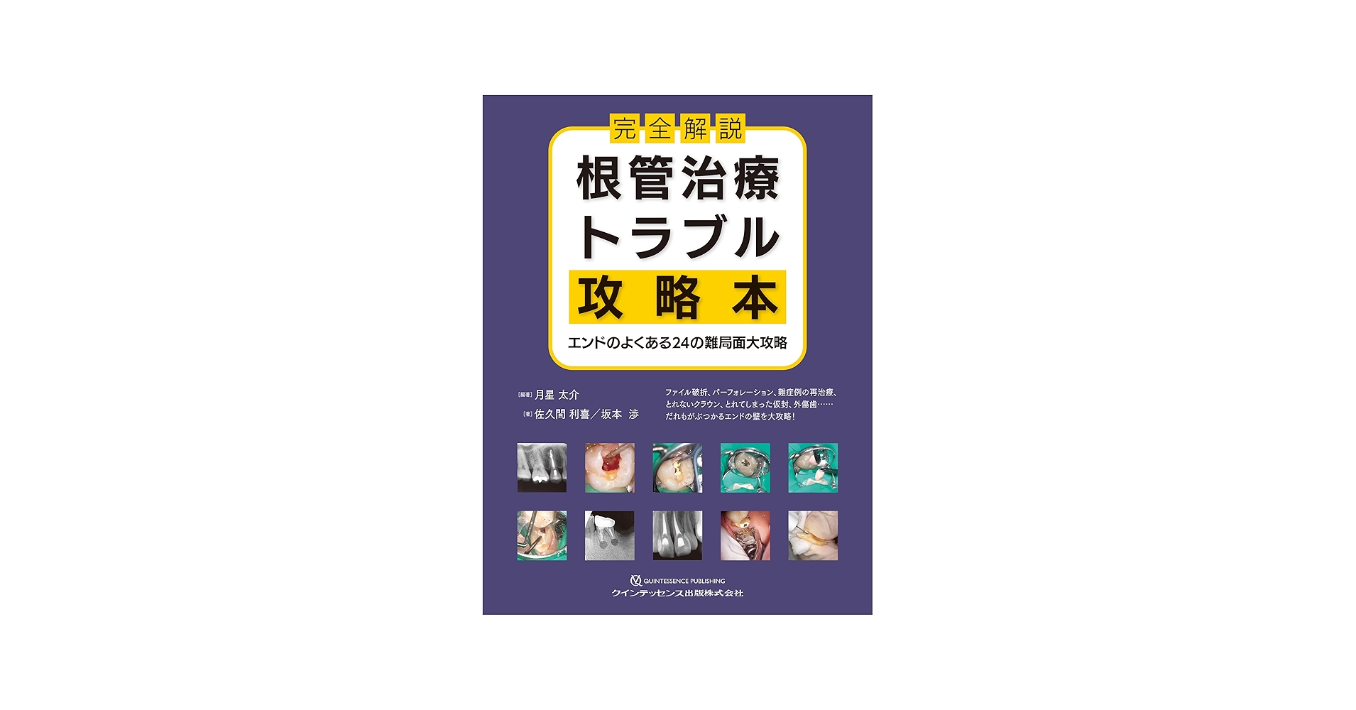 完全解説 根管治療トラブル攻略本: エンドのよくある24の難局面大攻略