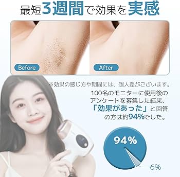 Amazon | Sarlisi 脱毛器 無痛脱毛 自動照射 60万発9段階 全身適用 vio