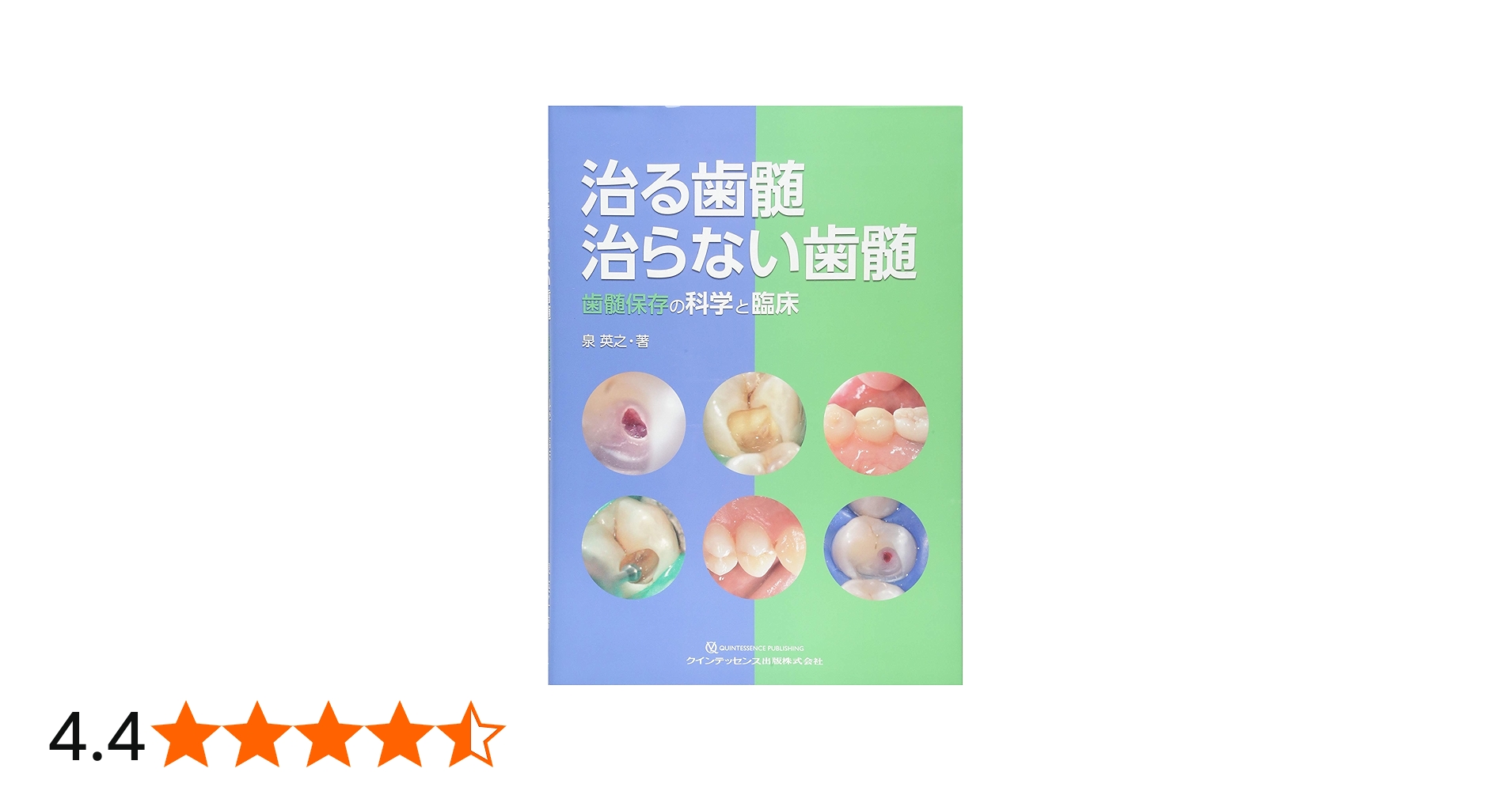 治る歯髄 治らない歯髄 | 泉 英之 |本 | 通販 | Amazon