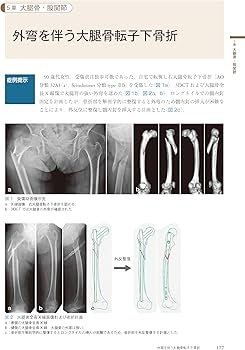 Amazon.co.jp: クリニカル・クエスチョンで考える外傷整形外科ケース
