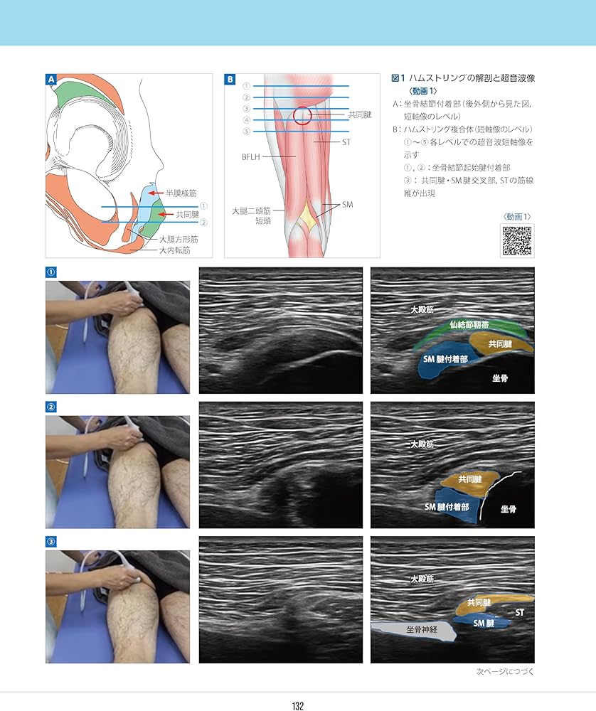 スポーツ障害〉筋損傷のエコー活用術 ―電子版付― | 和田 誠, 熊井 司