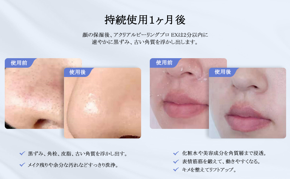 Amazon.co.jp: 美顔器 アクリアルピーリングプロEX COSBEAUTY